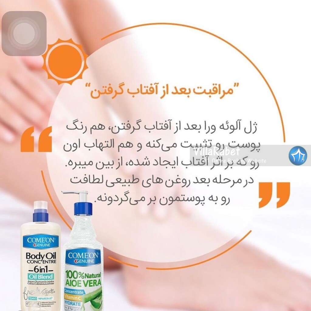 صفر تا صد آفتاب گرفتن کنار ساحل کجا آفتاب بگیریم، وسایل لازم برای آفتاب گرفتن، در شمال کجا آفتاب بگیریم، حمام آفتاب، ساحل مناسب آفتاب بانوان و دختران